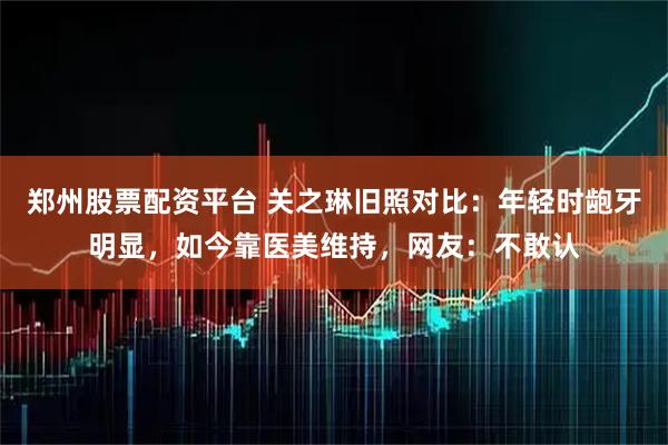 郑州股票配资平台 关之琳旧照对比：年轻时龅牙明显，如今靠医美维持，网友：不敢认